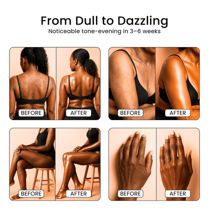 EasyRoad™ Body Gleam