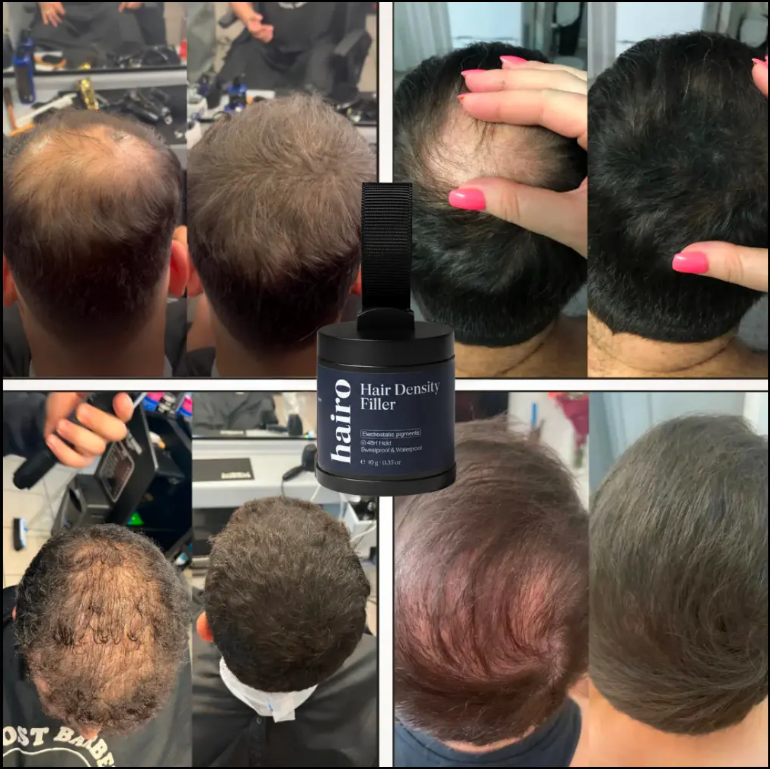 Hairo™ Hair Density Filler