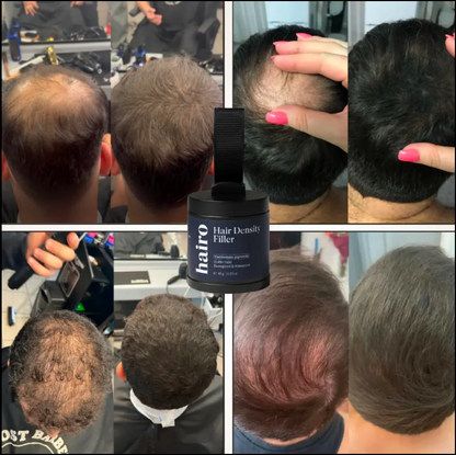 Hairo™ Hair Density Filler