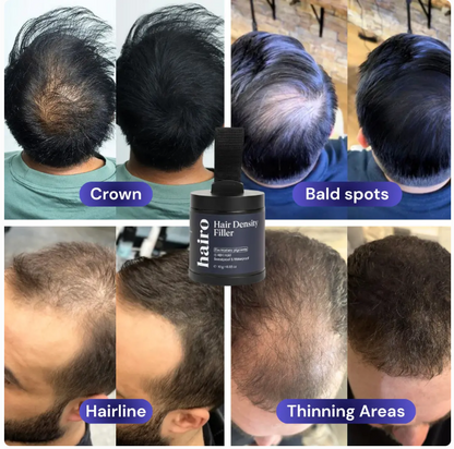 Hairo™ Hair Density Filler